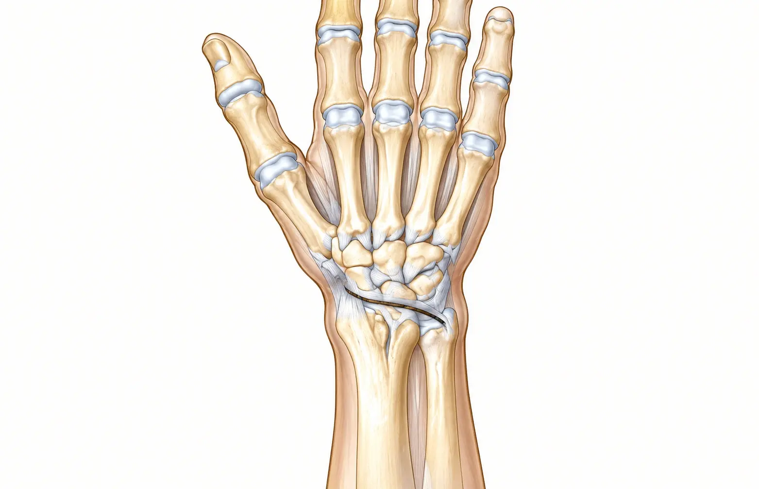 SL ligament (2) SL ligament (2)