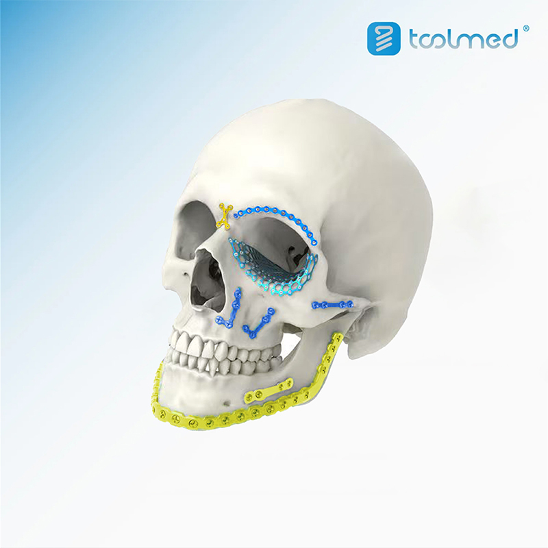 Maxillofacial-System