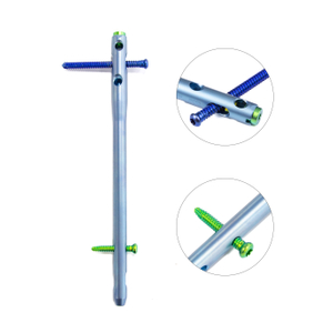 Hindfoot Fusion Ankle Nail