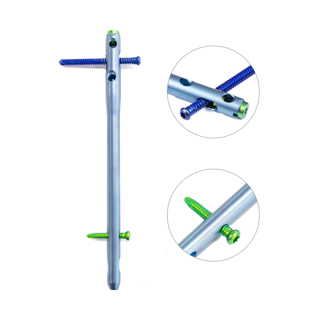 Hindfoot Fusion Ankle Nail