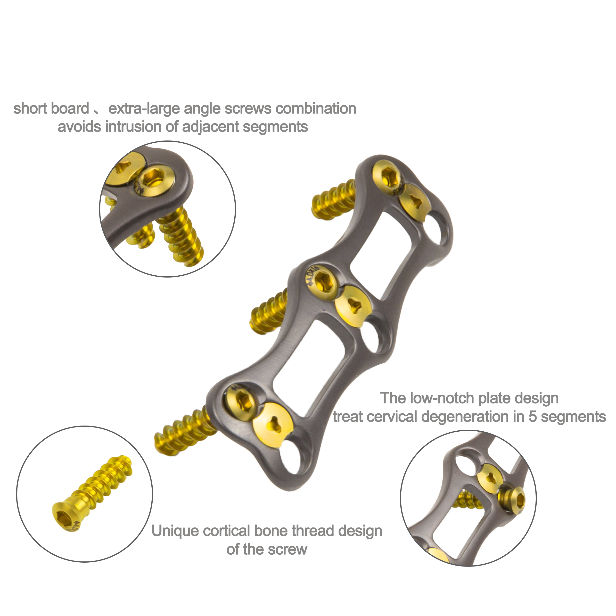 CERVINO Anterior Cervical Plate