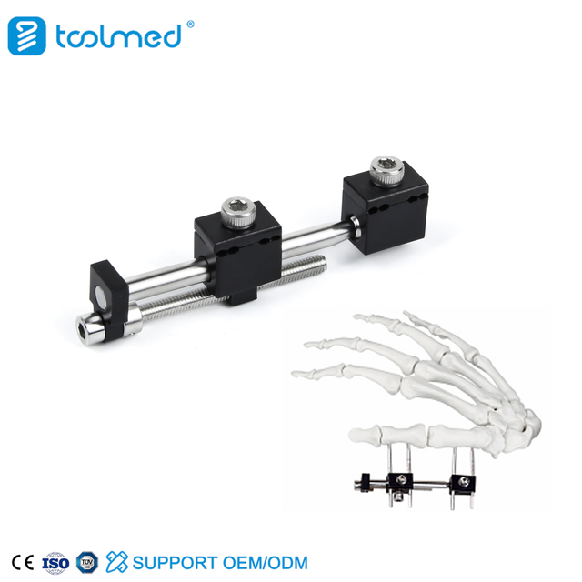 Mini Fragment External Fixator (Finger and Palm) 5100-0103