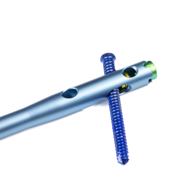 Hindfoot Fusion Ankle Nail