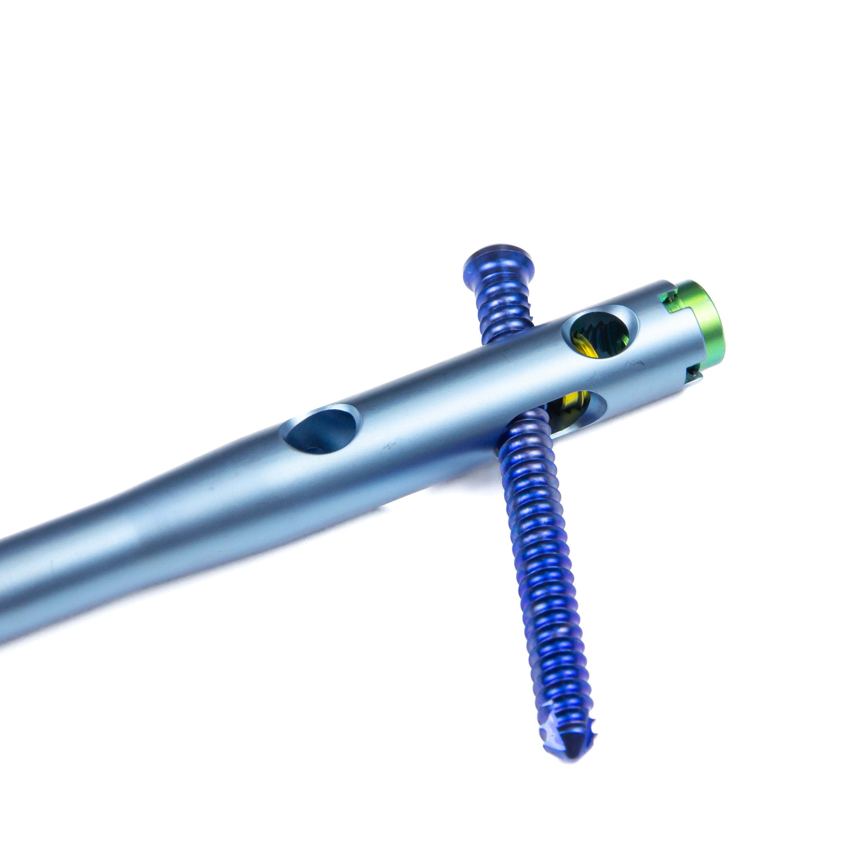 Hindfoot Fusion Ankle Nail