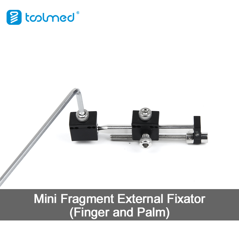 Mini Fragment External Fixator