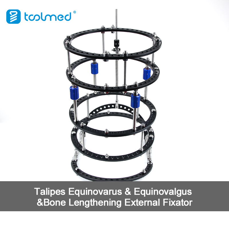 Talipes Equinovarus & Equinovalgus & Bone Lengthening External Fixator