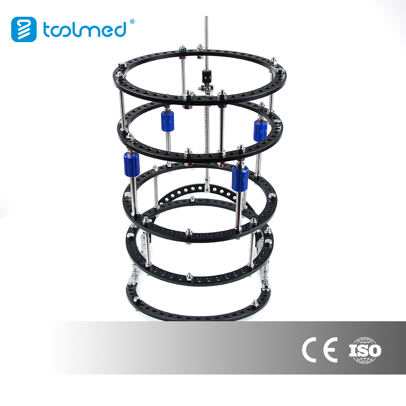 Talipes Equinovarus & Equinovalgus & Bone Lengthening External Fixator