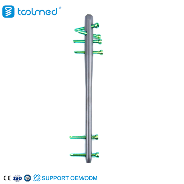 Expert Reversed Femoral Intramedullary Nail-II