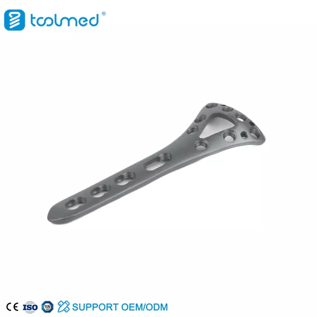 Distal Dorsal Radial Delta Locking Plate