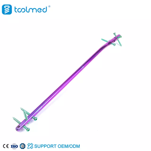 Expert Tibia Nail