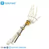 UIna & Radius External Fixator 