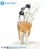Mini Fixator Joint Motion Type