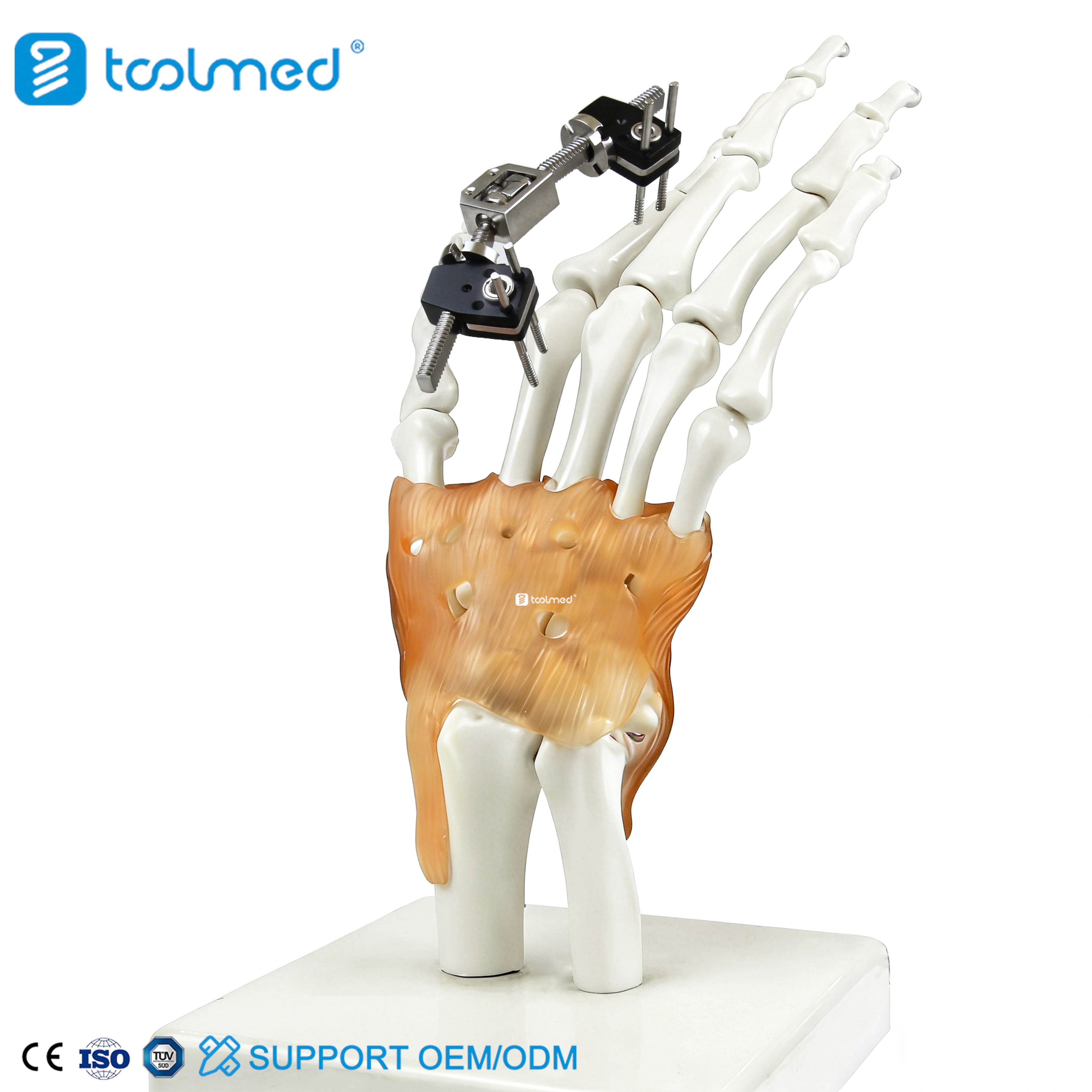 Mini Fixator Joint Motion Type
