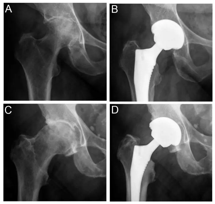 Postoperative X-ray.webp