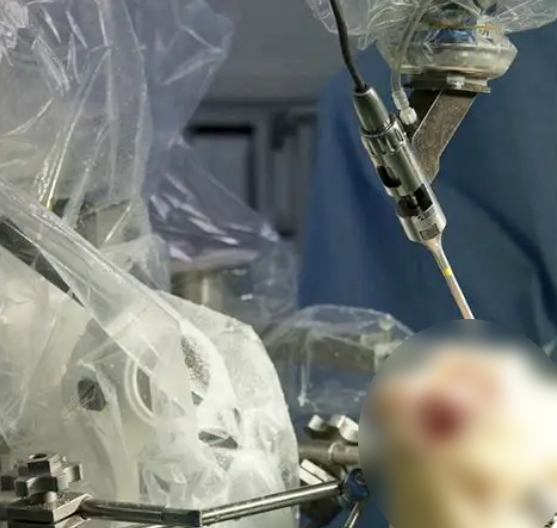 TSOLUTION ONE&reg; Active Machine System.jpg