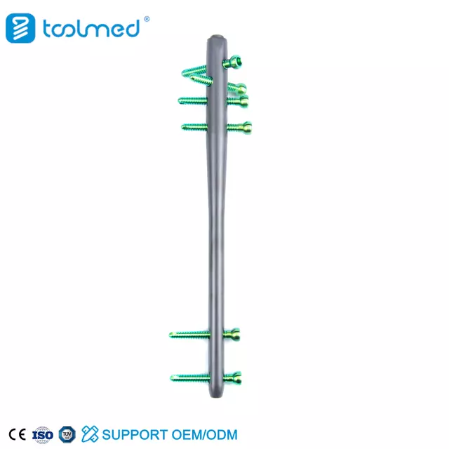 Expert Reversed Femoral Intramedullary Nail-II