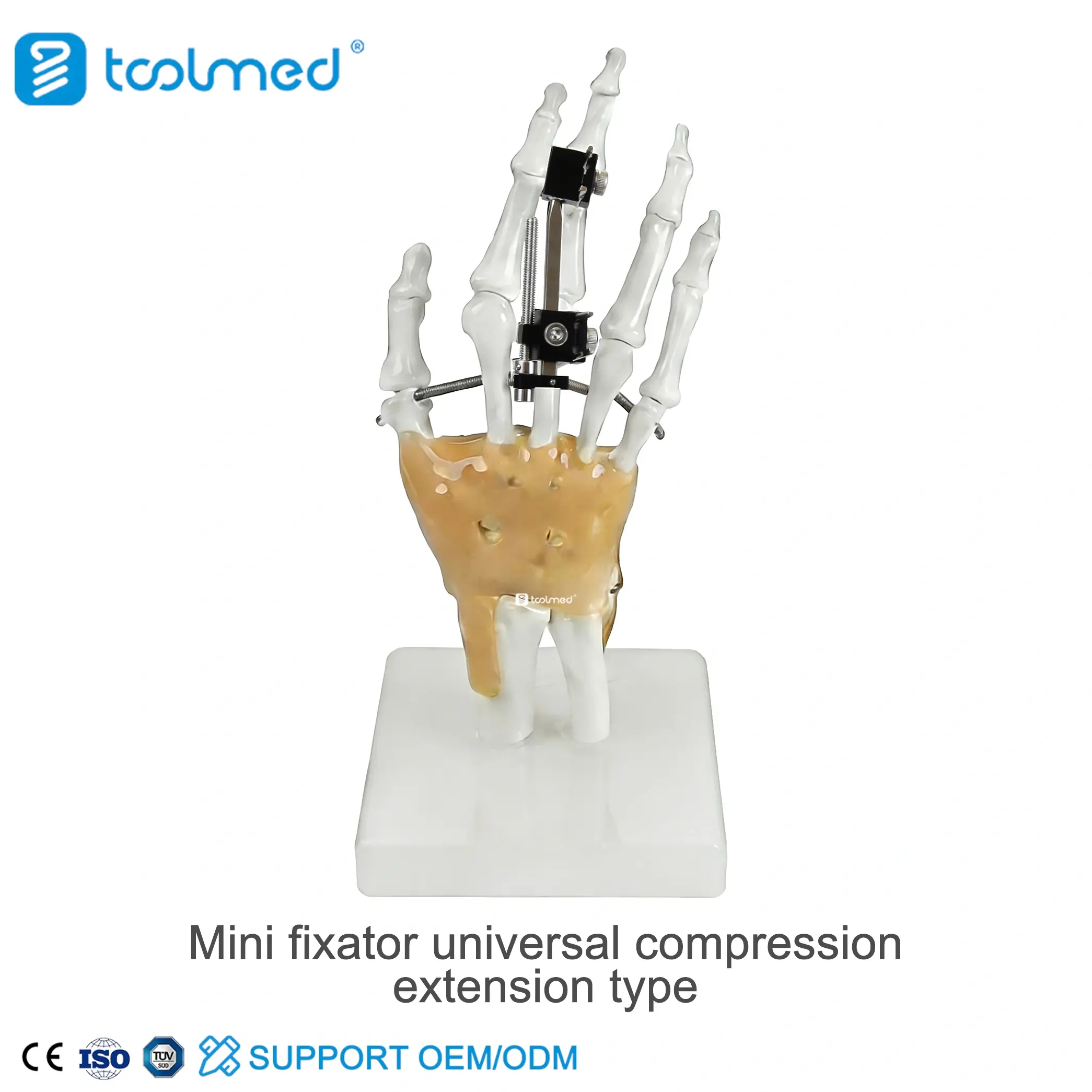 Mini Fragment External Fixator 3