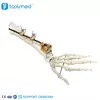 UIna & Radius External Fixator 