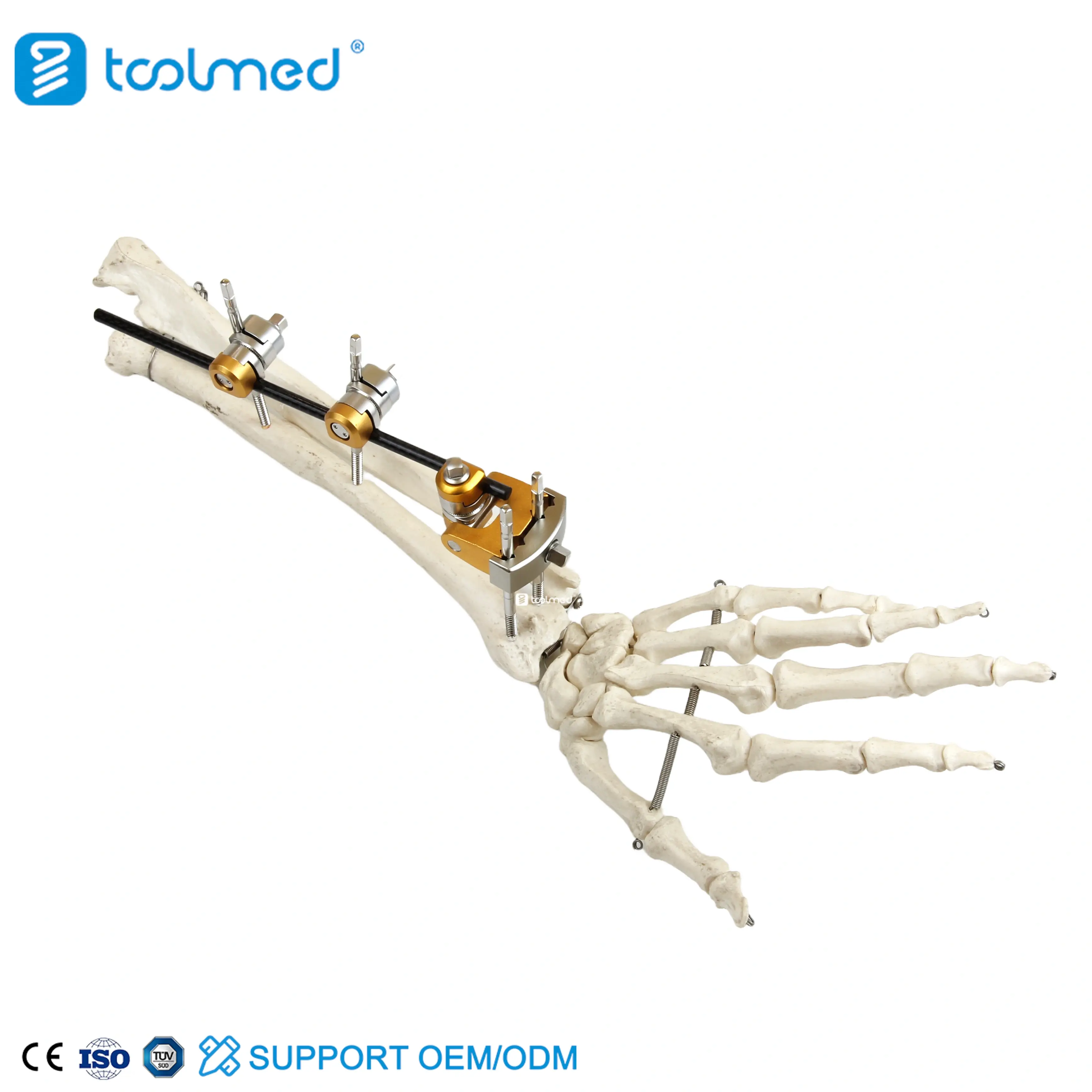 UIna & Radius External Fixator 