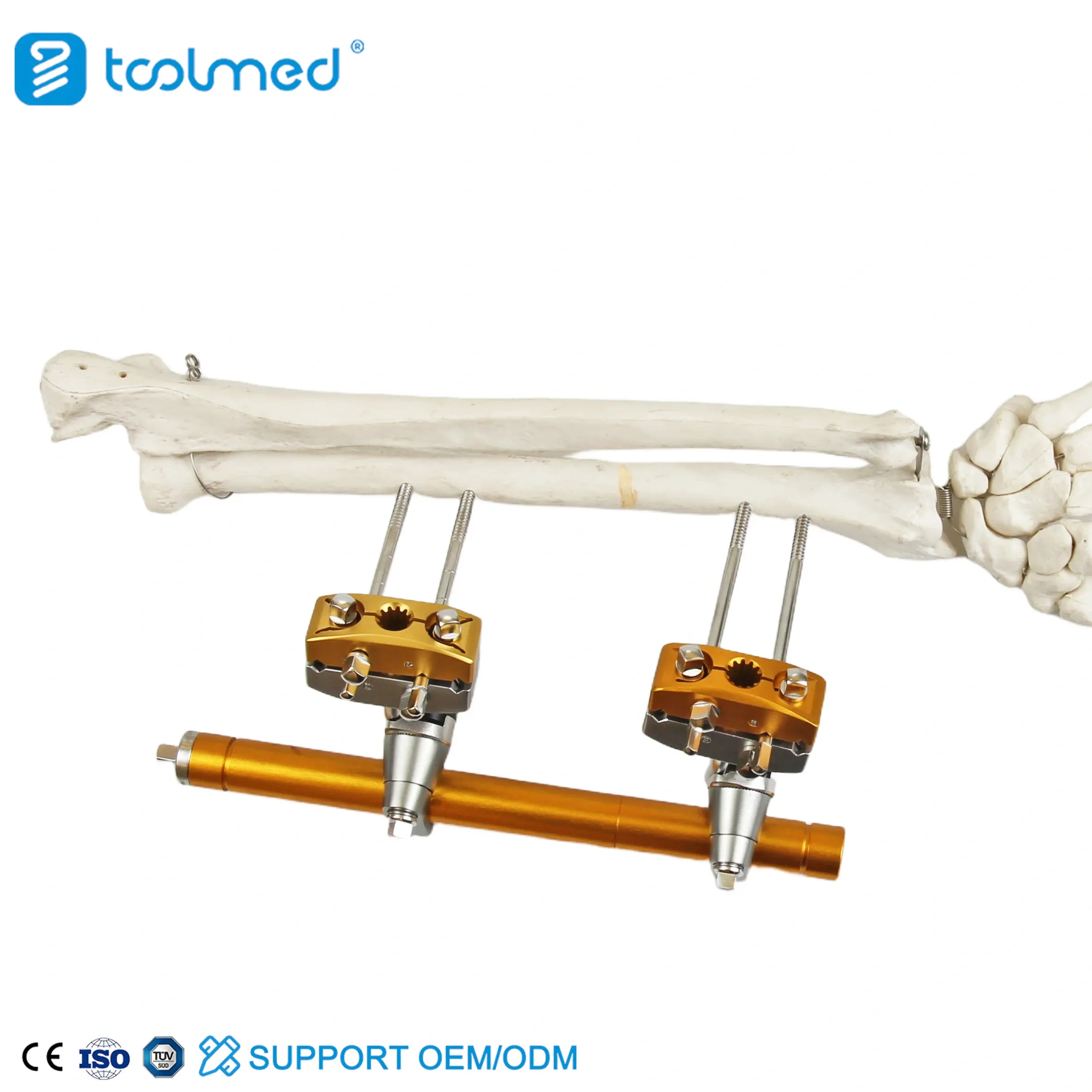 Humeral Shaft External Fixator