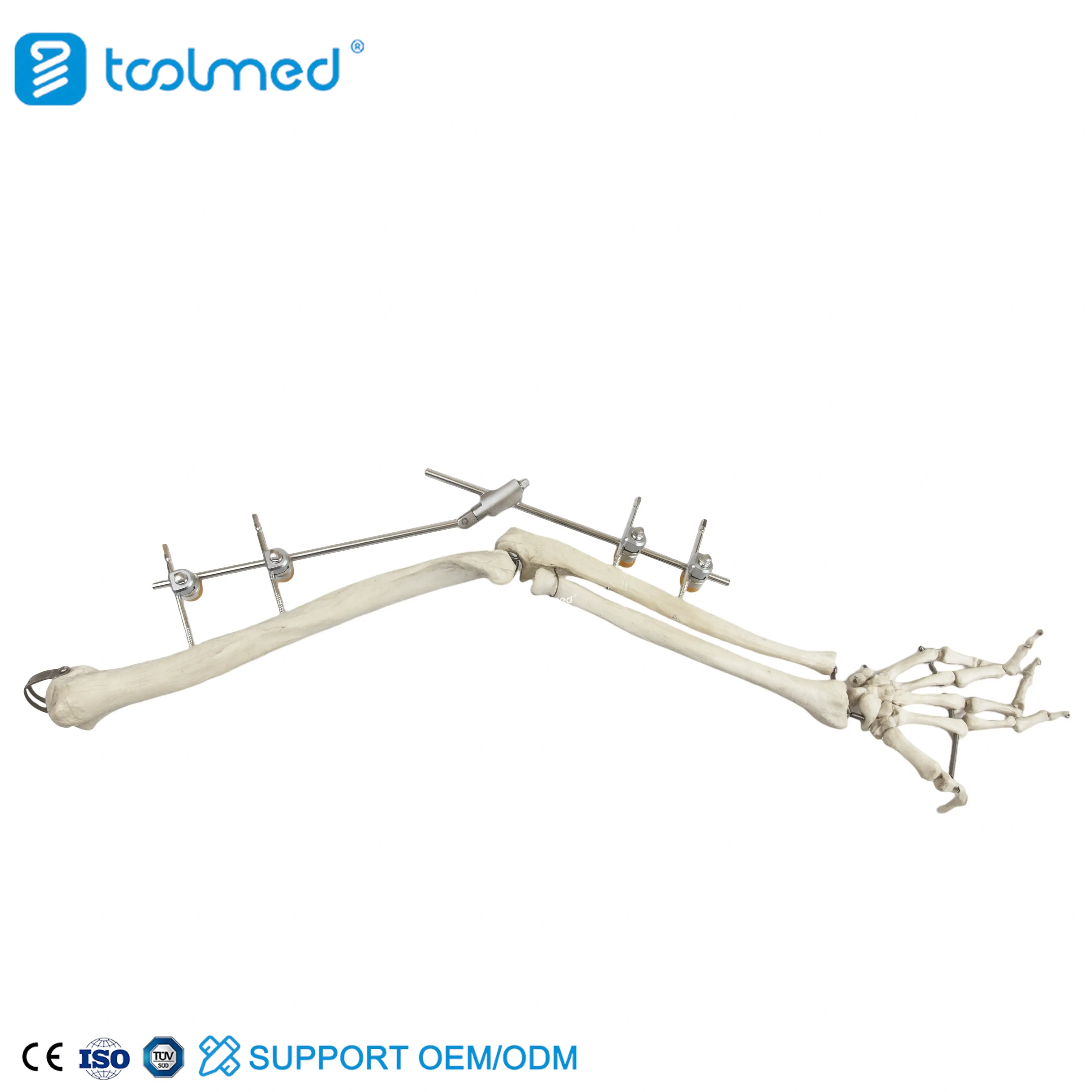 Elbow Joint External Fixator