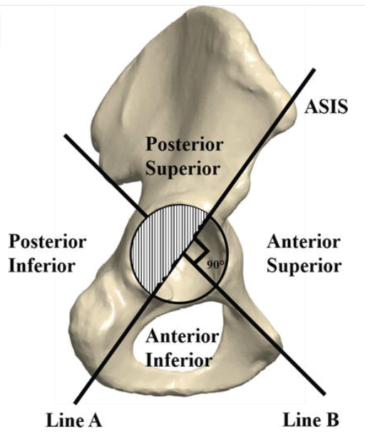 total hip surgery.png