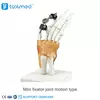Mini Fixator Joint Motion Type