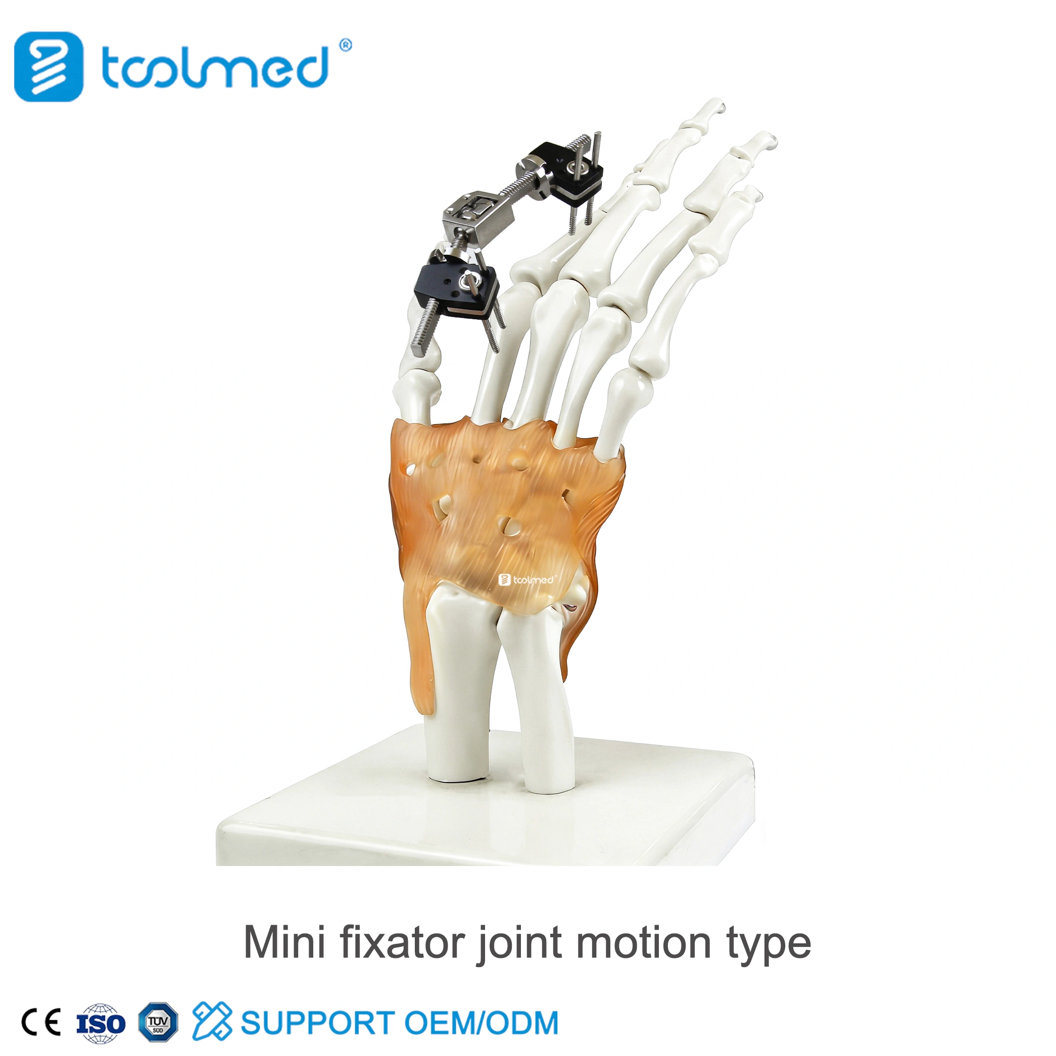 Mini Fixator Joint Motion Type