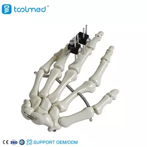 Mini Fixator Universal Type