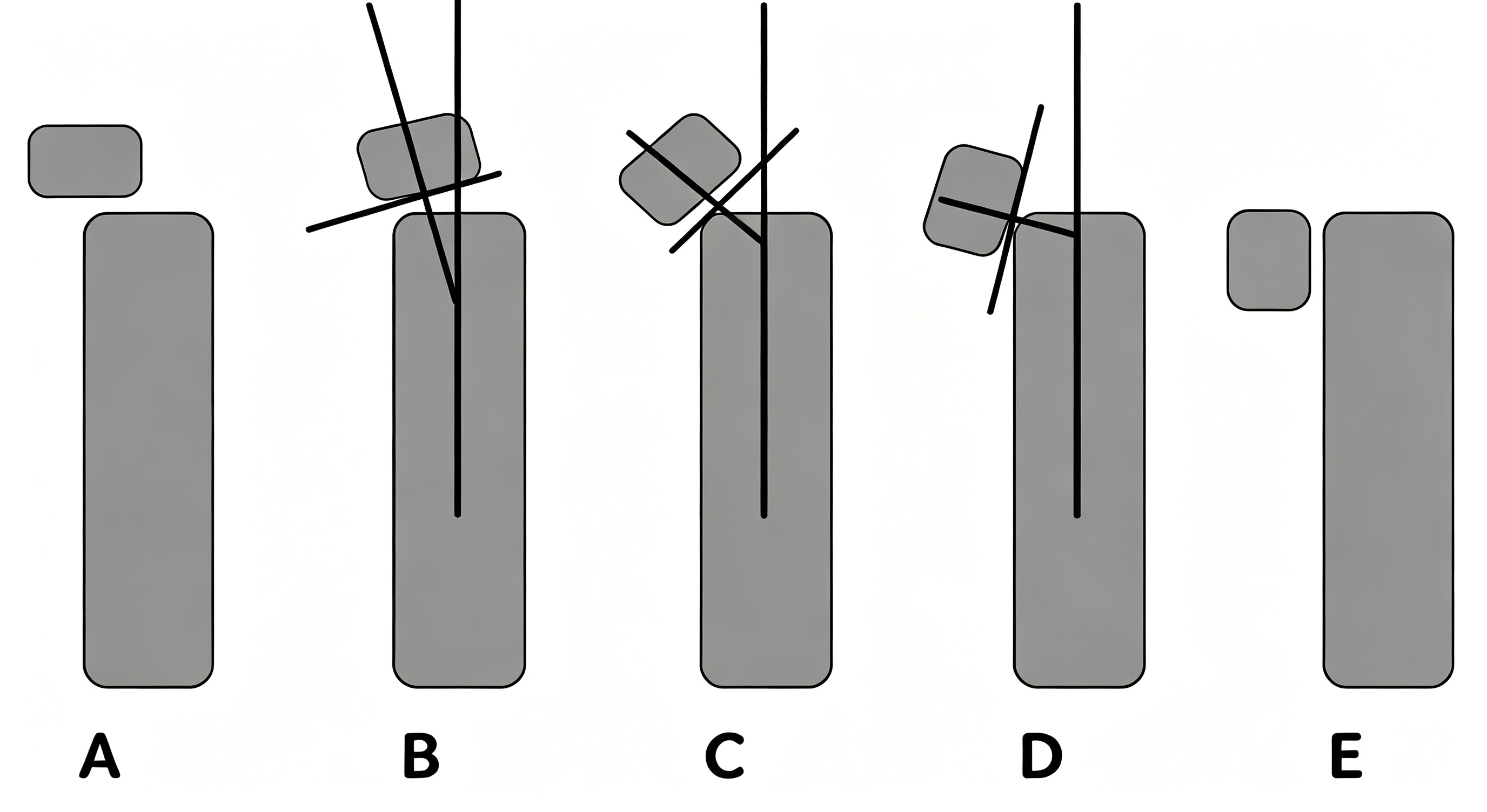 Judet's classification1.png