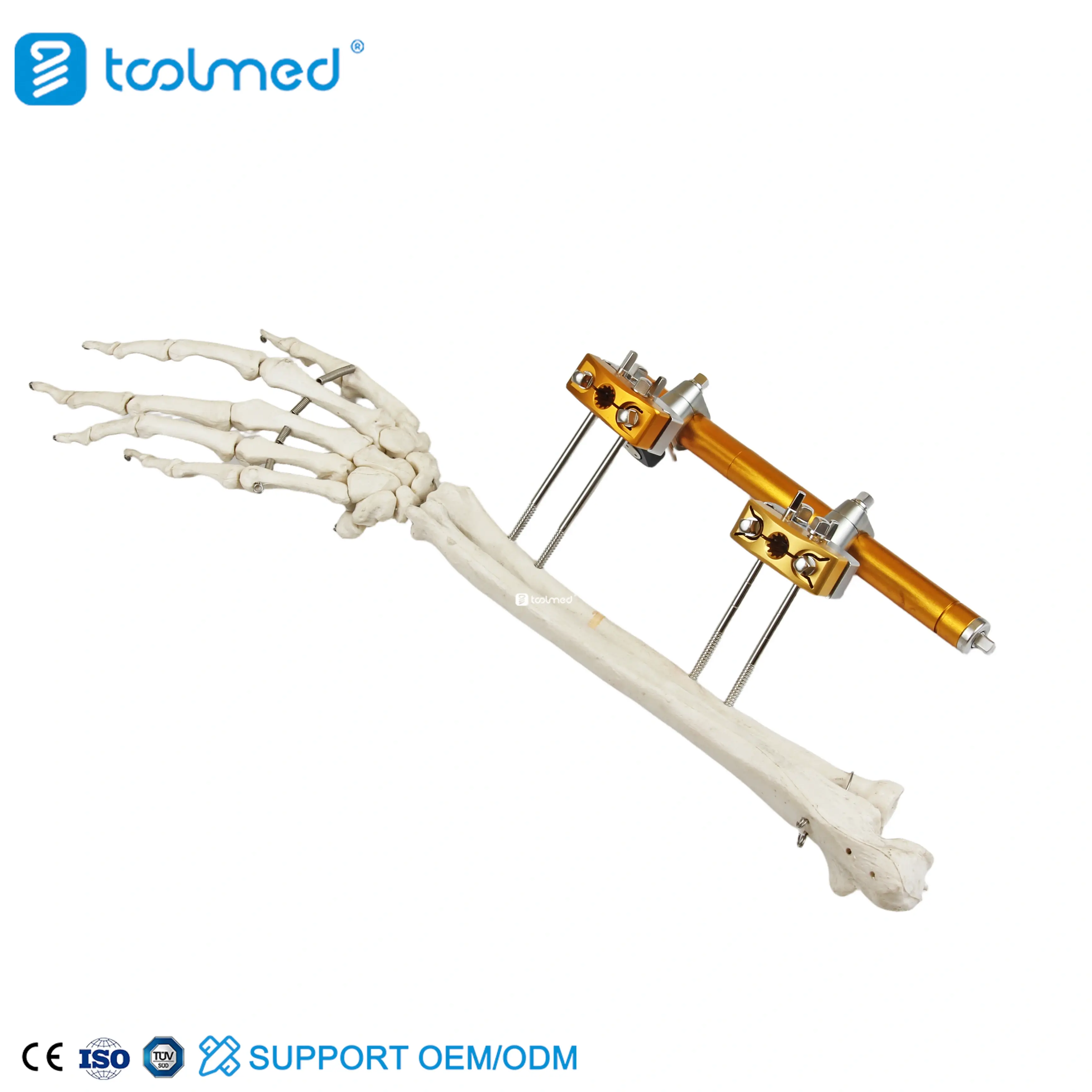 Humeral Shaft External Fixator