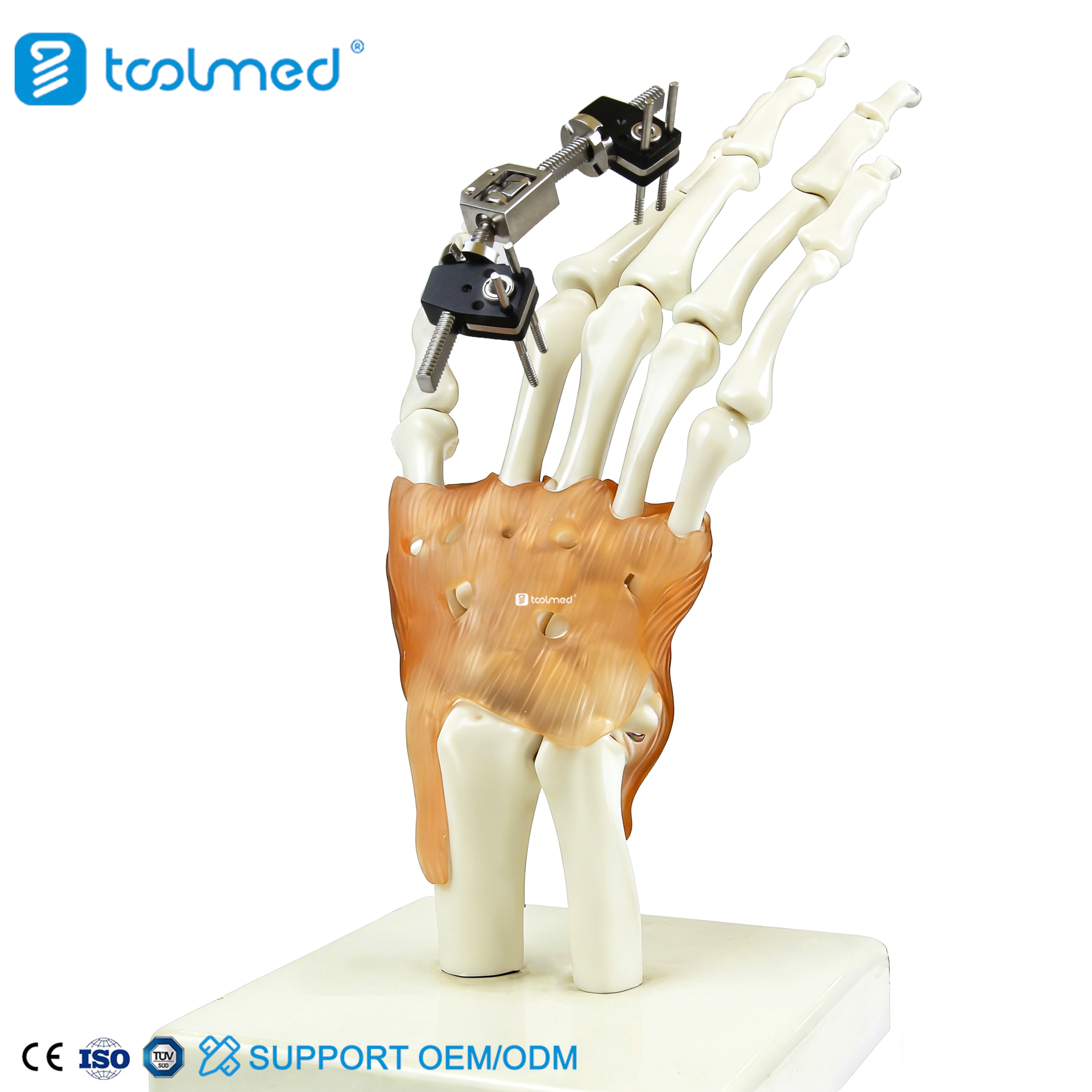 Mini fixator joint motion type