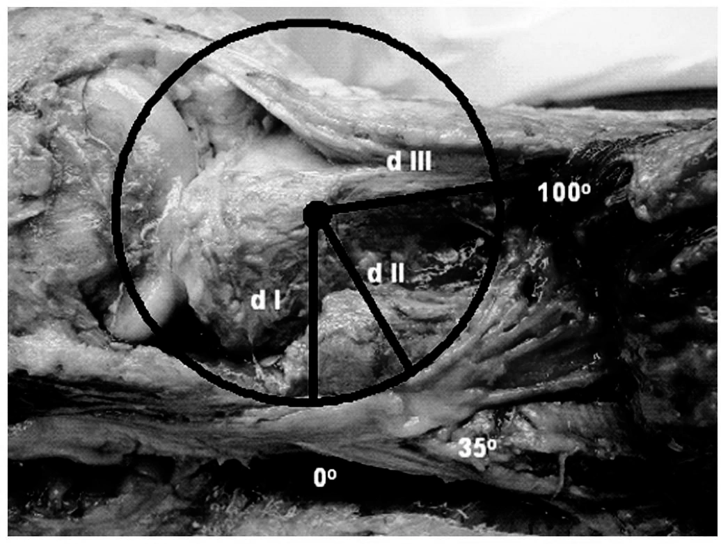 A nerve-free annular region at the proximal tibia.webp