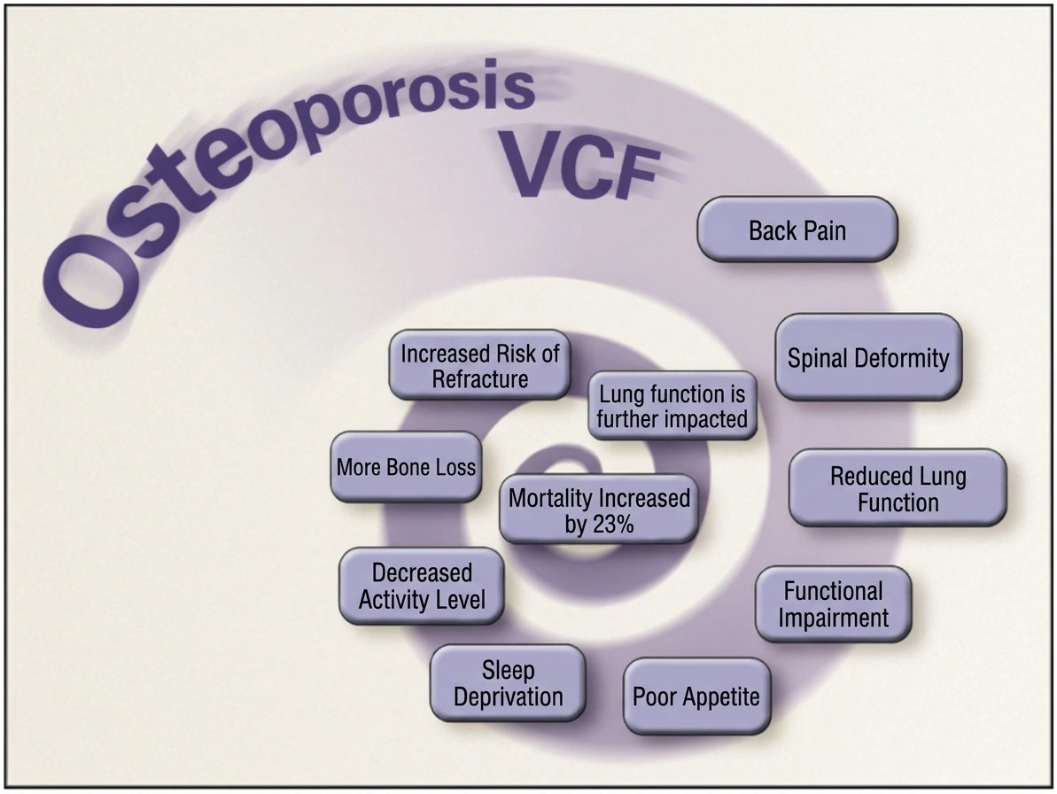 The vicious cycle of OVCF