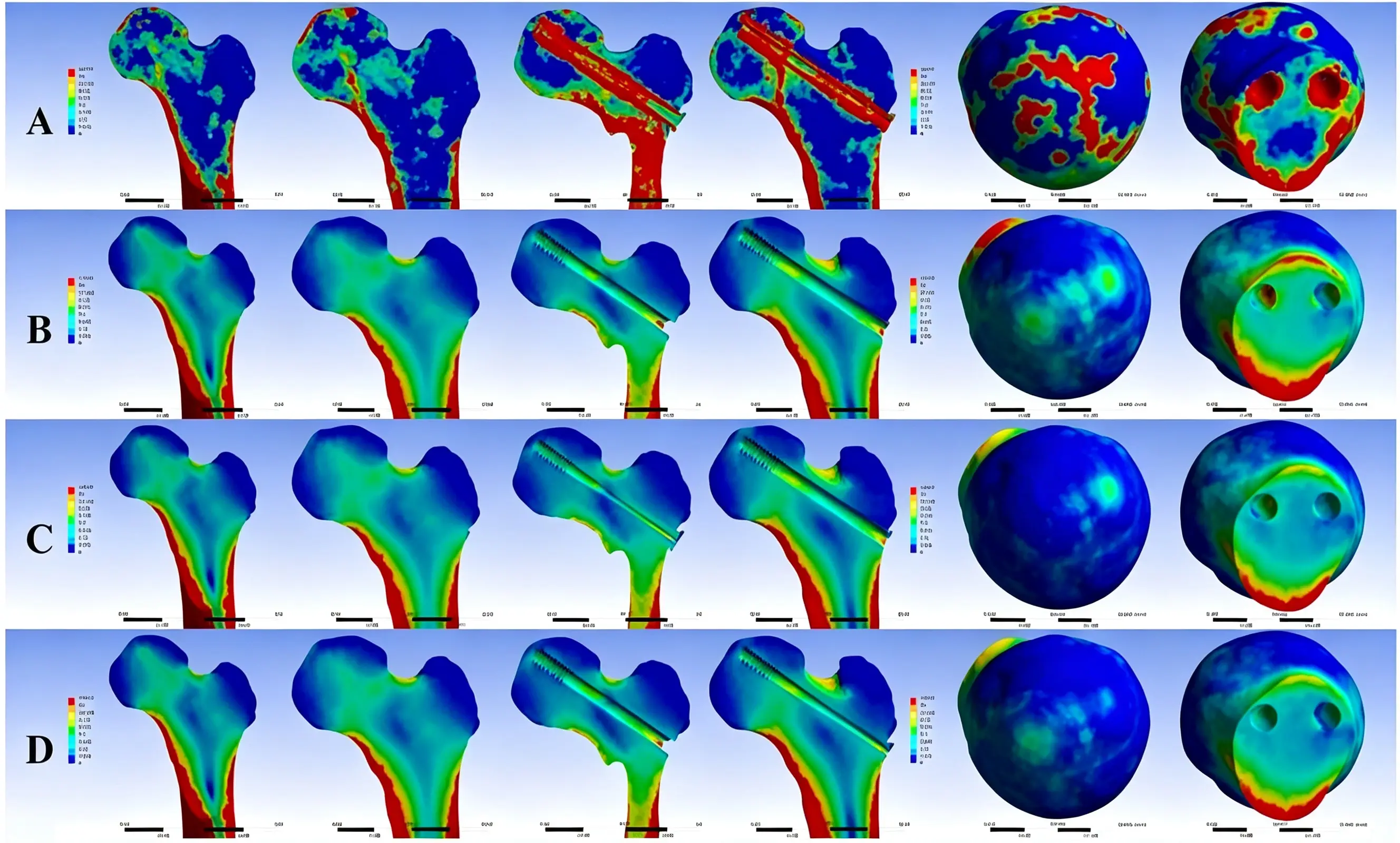 Femur model