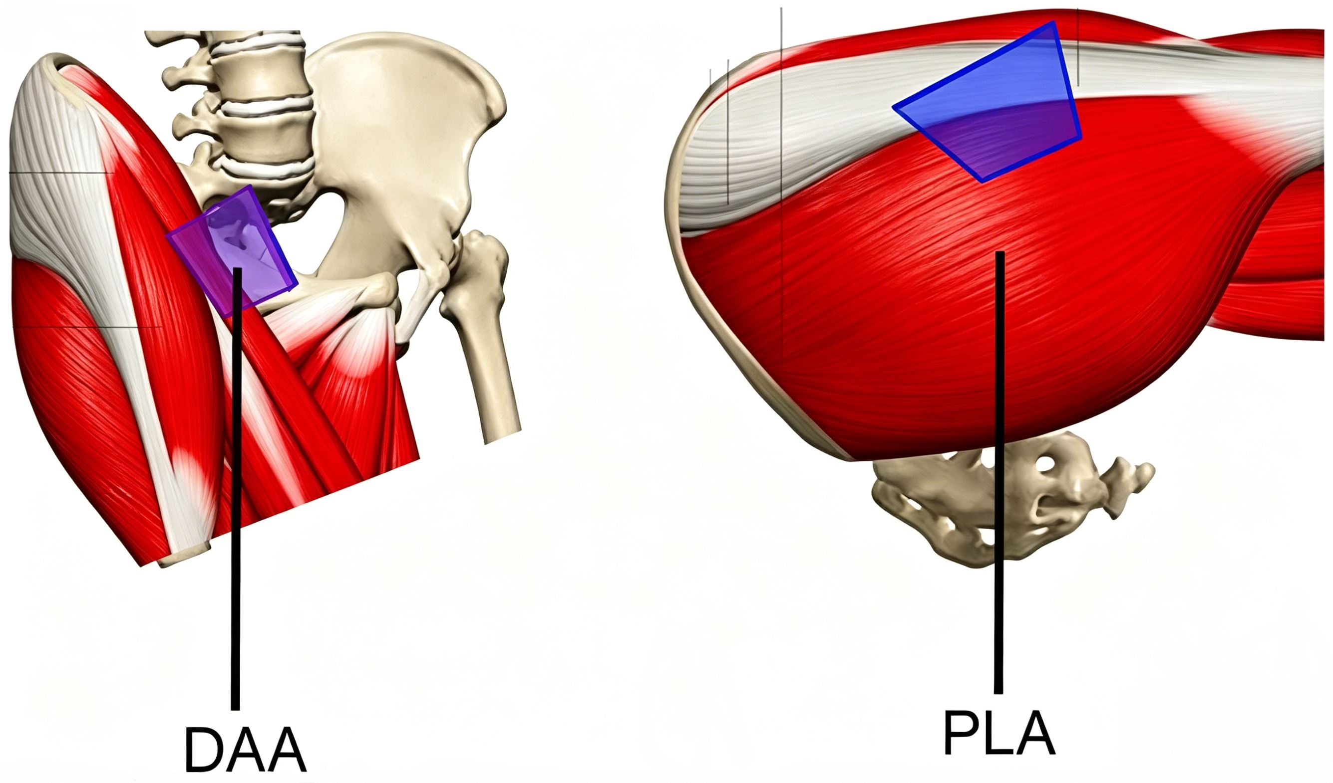 Hip Joint Deformity and Revision Surgery.jpg