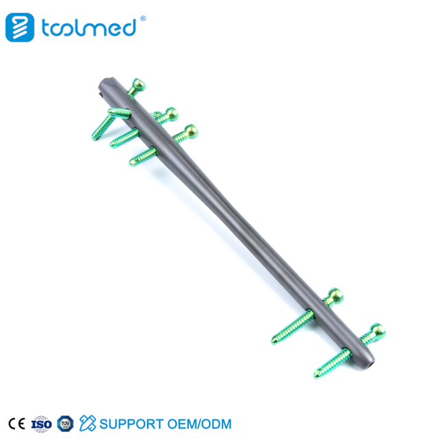 Expert Reversed Femoral Intramedullary Nail-II