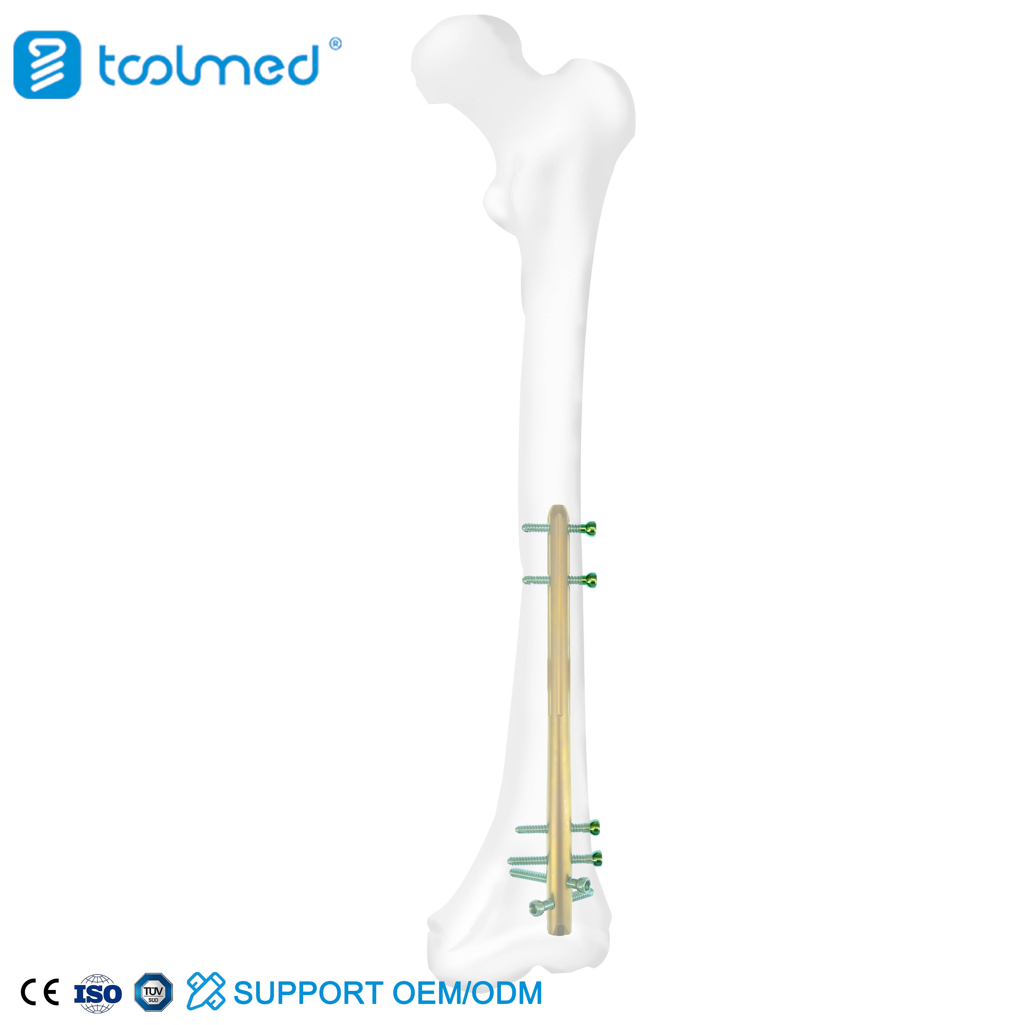 Expert Reversed Femoral Intramedullary Nail-I
