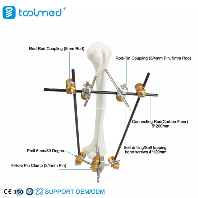 Humeral Shaft External Fixator 5300-10