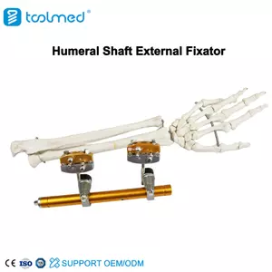 Humeral Shaft External Fixator