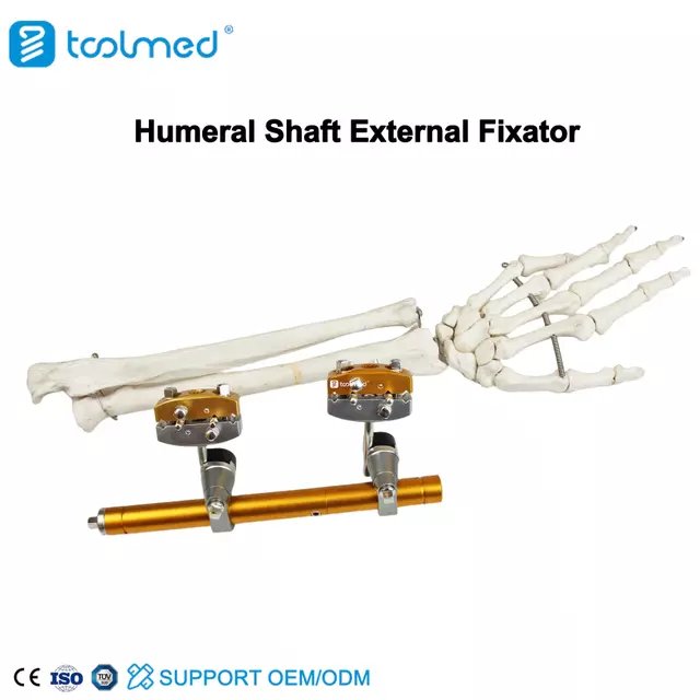 Humeral Shaft External Fixator
