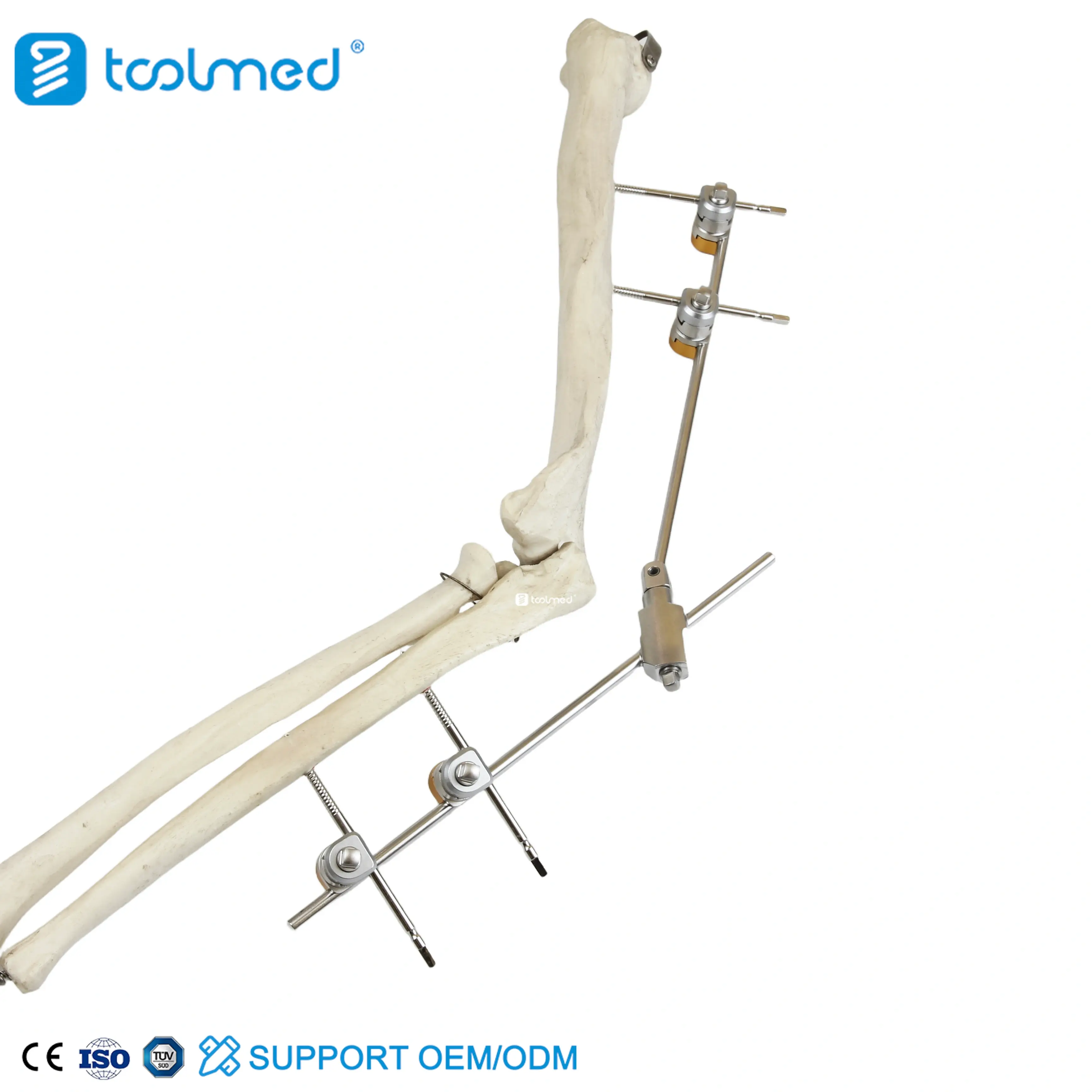Elbow Joint External Fixator