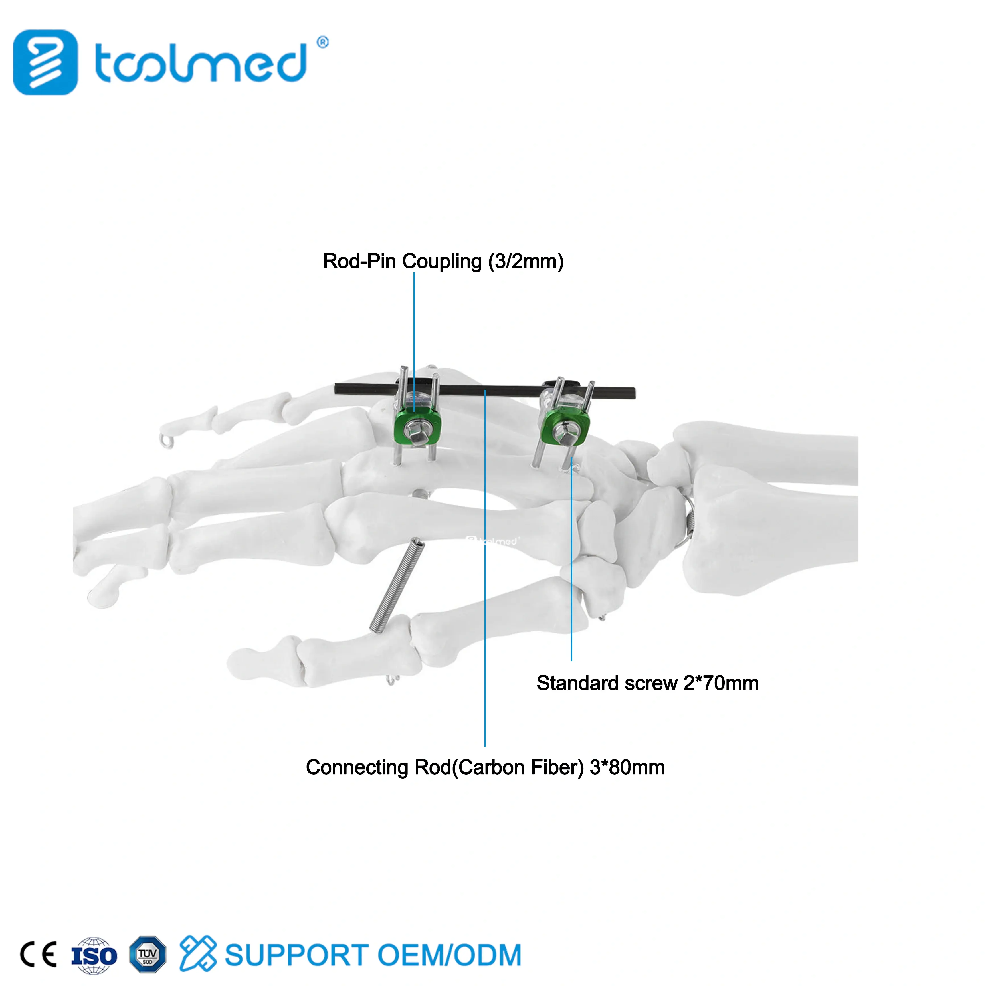 Finger & Palm External Fixator