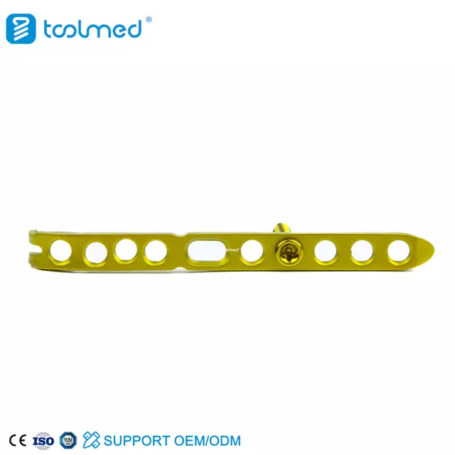 Distal Ulnar Locking Plate