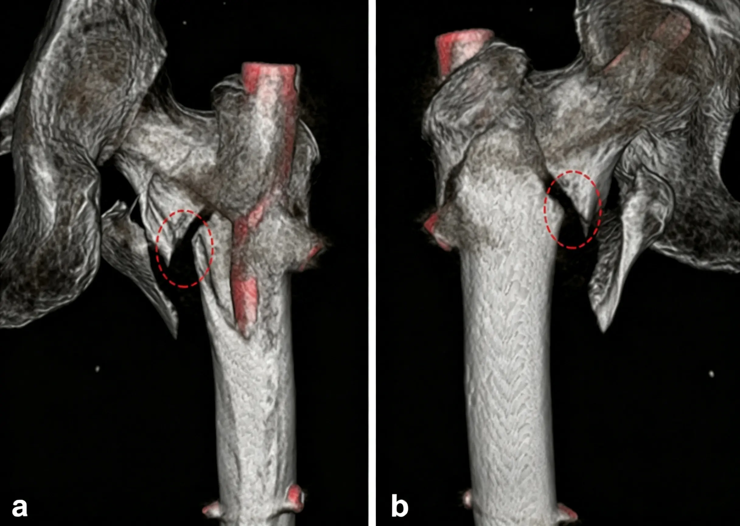 3D CT reconstruction