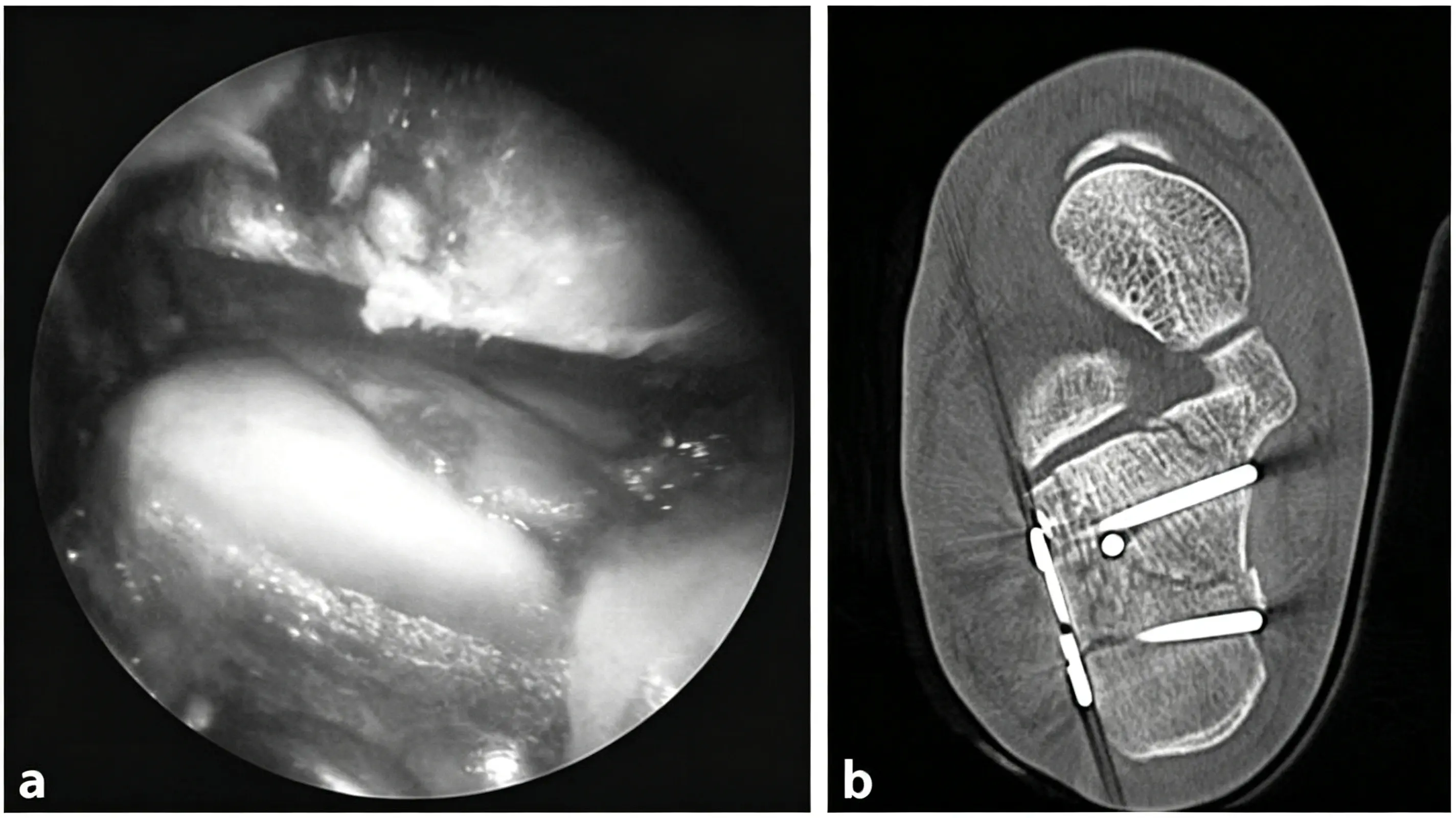 Arthroscopic exploration imaging (1) (1)
