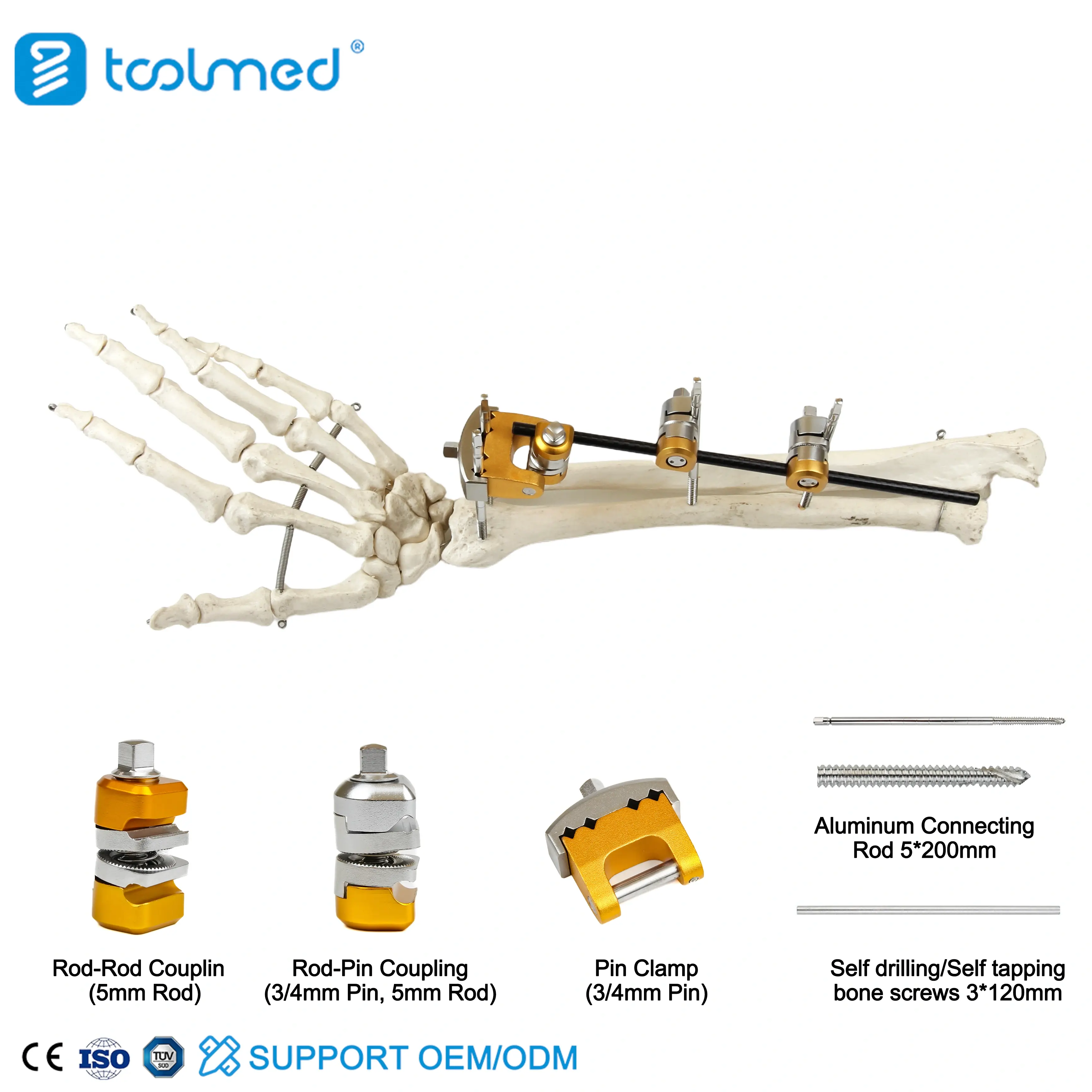 UIna & Radius External Fixator 
