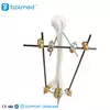 Humeral Shaft External Fixator 5300-10