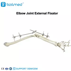 Elbow Joint External Fixator
