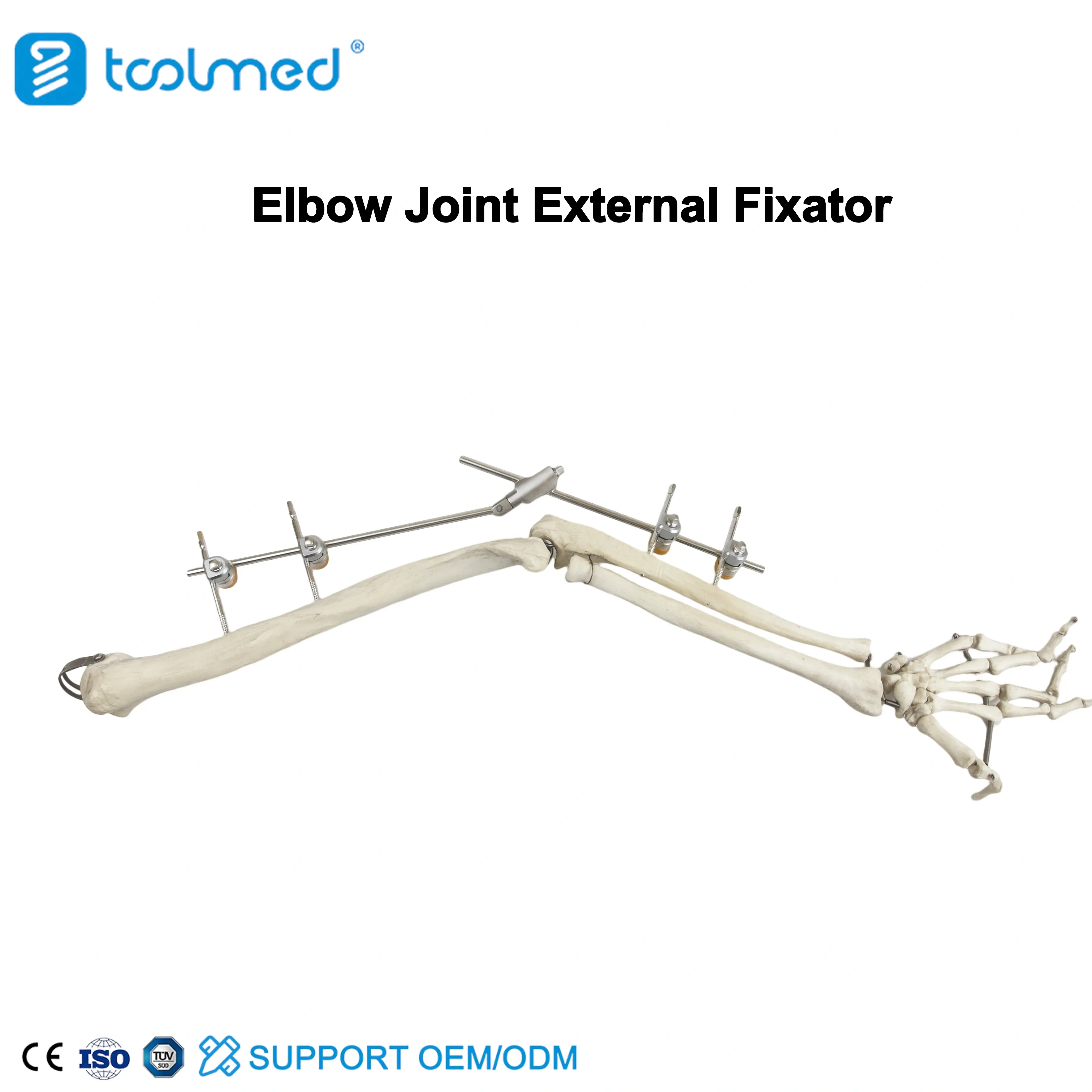 Elbow Joint External Fixator